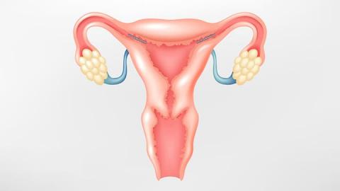 Bayer Loses $413M for Essure as Lawsuits Pile Up