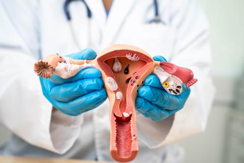 Has Bayer Stopped Downplaying the Risks of Essure?